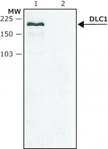 Anti-DLC1 (C-terminal) antibody produced in rabbit SAB4200352-200UL