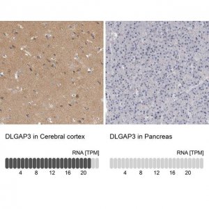 Anti-DLGAP3 antibody produced in rabbit 