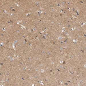 Anti-DLGAP3 antibody produced in rabbit 