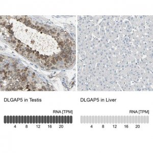 Anti-DLGAP5 antibody produced in rabbit 