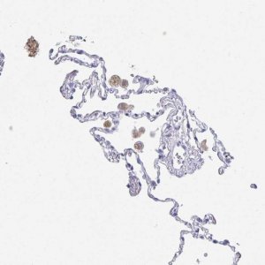 Anti-DMBT1 antibody produced in rabbit 