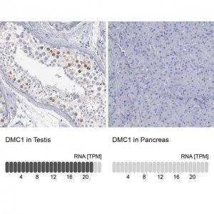 Anti-DMC1 antibody produced in rabbit 