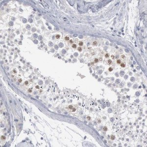 Anti-DMC1 antibody produced in rabbit 
