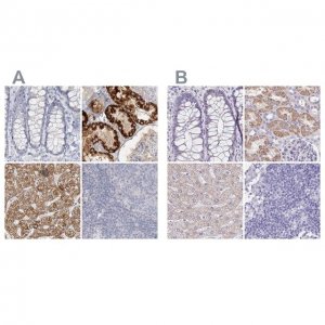 Anti-DMGDH antibody produced in rabbit 