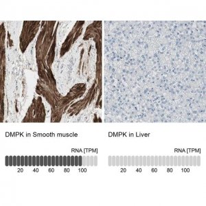 Anti-DMPK antibody produced in rabbit 