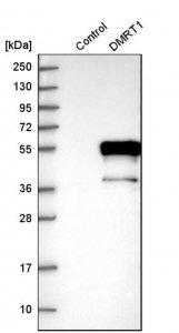Anti-DMRT1 antibody produced in rabbit 