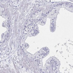 Anti-DMRTB1 antibody produced in rabbit 