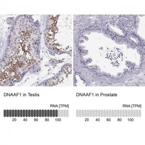 Anti-DNAAF1 