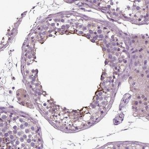 Anti-DNAH10 antibody produced in rabbit 