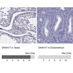 Anti-DNAH17 