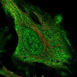 Anti-DNAH17 antibody produced in rabbit 