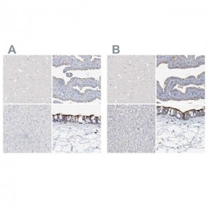 Anti-DNAH5 antibody produced in rabbit 