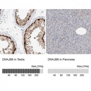 Anti-DNAJB6 antibody produced in rabbit HPA024258-100UL