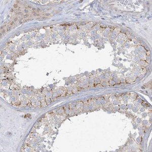 Anti-DNAJC18 antibody produced in rabbit 