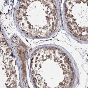 Anti-DNAJC27 antibody produced in rabbit 