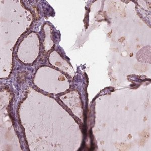 Anti-DNASE2 antibody produced in rabbit 