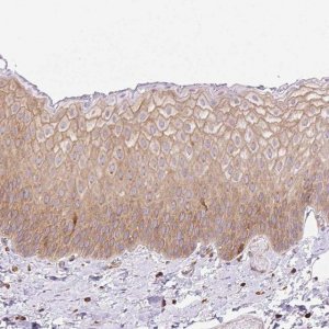 Anti-DNM2 antibody produced in rabbit HPA054246-100UL