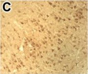 Anti-DNMT1 antibody produced in rabbit 
