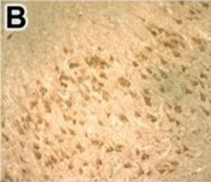 Anti-DNMT1 antibody produced in rabbit 