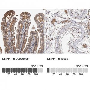 Anti-DNPH1 antibody produced in rabbit HPA029675-100UL