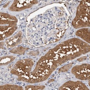 Anti-DNPH1 antibody produced in rabbit HPA029675-100UL