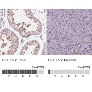 Anti-DNTTIP2 antibody produced in rabbit 