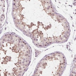 Anti-DNTTIP2 antibody produced in rabbit 