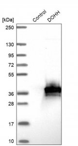 Anti-DOHH antibody produced in rabbit 