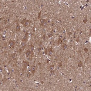 Anti-DOHH antibody produced in rabbit 