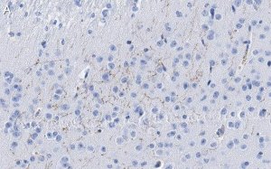 Anti-Dopamine Transporter Antibody, clone 1D2 ZooMAb Rabbit Monoclonal 