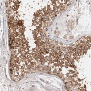 Anti-DOPEY1 antibody produced in rabbit 