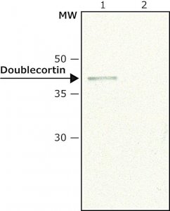 Anti-Doublecortin (N-terminal) antibody produced in rabbit 