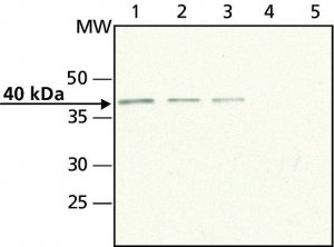 Anti-Doublecortin (N-terminal) antibody produced in rabbit 