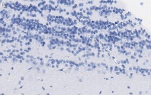 Anti-Doublecortin Antibody, clone 3F11 ZooMAb Rabbit Monoclonal 
