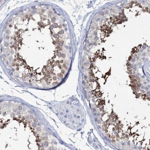 Anti-DPCD antibody produced in rabbit 