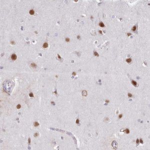 Anti-DPF1 antibody produced in rabbit 