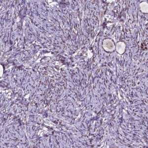 Anti-DPF3 antibody produced in rabbit 