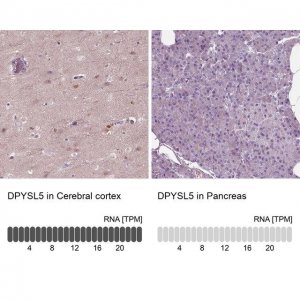 Anti-DPYSL5 antibody produced in rabbit 