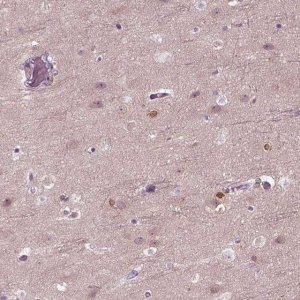 Anti-DPYSL5 antibody produced in rabbit 