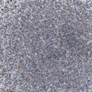 Anti-DRAM2 antibody produced in rabbit 