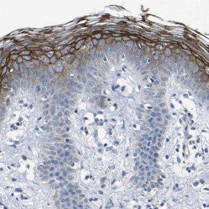 Anti-DSC1 antibody produced in rabbit 