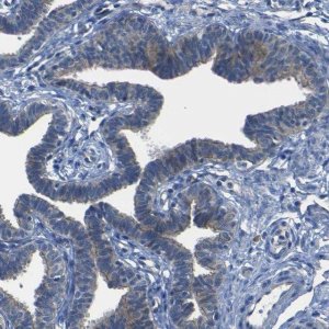 Anti-DSC1 antibody produced in rabbit 