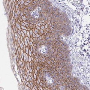 Anti-DSC3 antibody produced in rabbit 