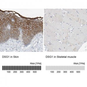 Anti-DSG1 antibody produced in rabbit HPA022128-100UL