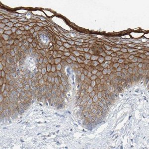 Anti-DSG1 antibody produced in rabbit HPA022128-100UL