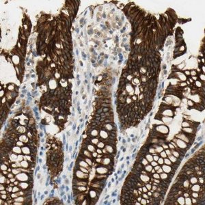 Anti-DSG2 antibody produced in rabbit 