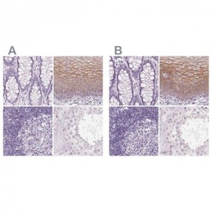 Anti-DSG3 antibody produced in rabbit 