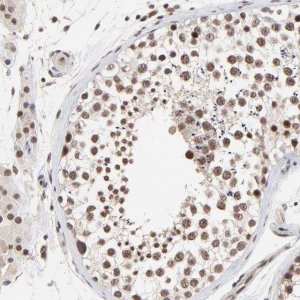 Anti-DSN1 antibody produced in rabbit 