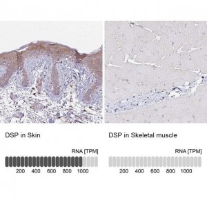 Anti-DSP antibody produced in rabbit 