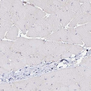 Anti-DSP antibody produced in rabbit 